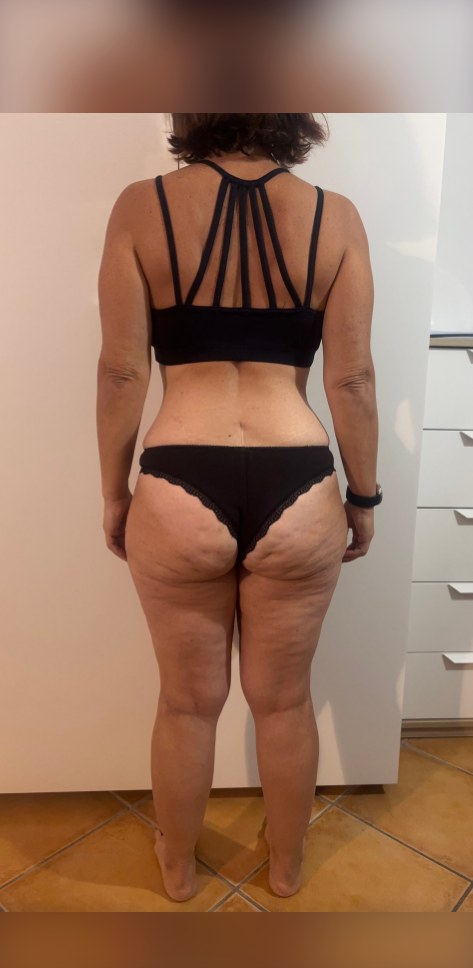 Elisa dopo −9 kg